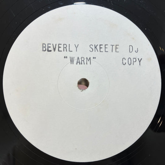 Beverley Skeete – Warm